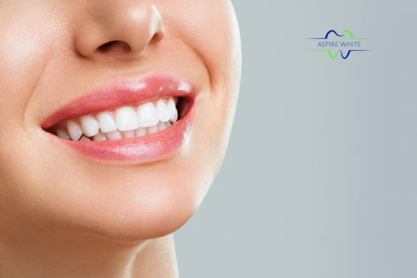 Safe and effective laser whitening treatment for visibly whiter teeth Exeter