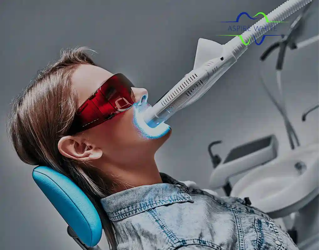 1 Hour Teeth Whitening with Aspire White Exeter