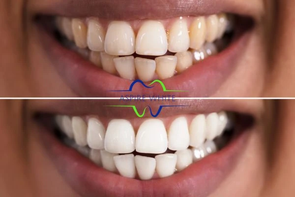 Aspire White customer before and after Exeter results.