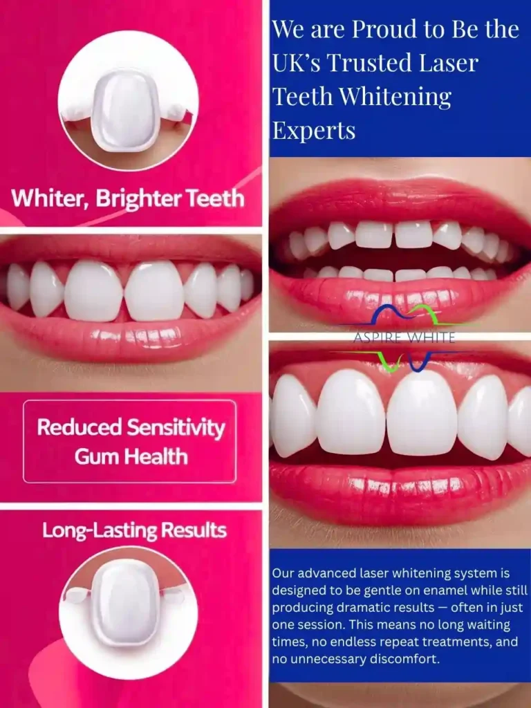 We are Proud to Be the UK’s Trusted Laser Teeth Whitening Experts Exeter